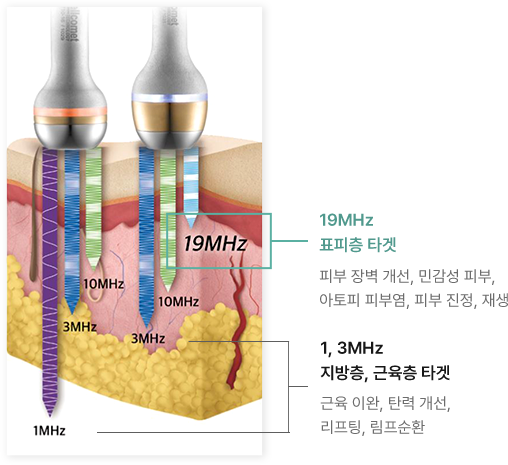 표피층 타겟