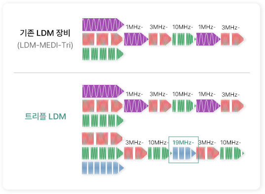 트리플 LDM